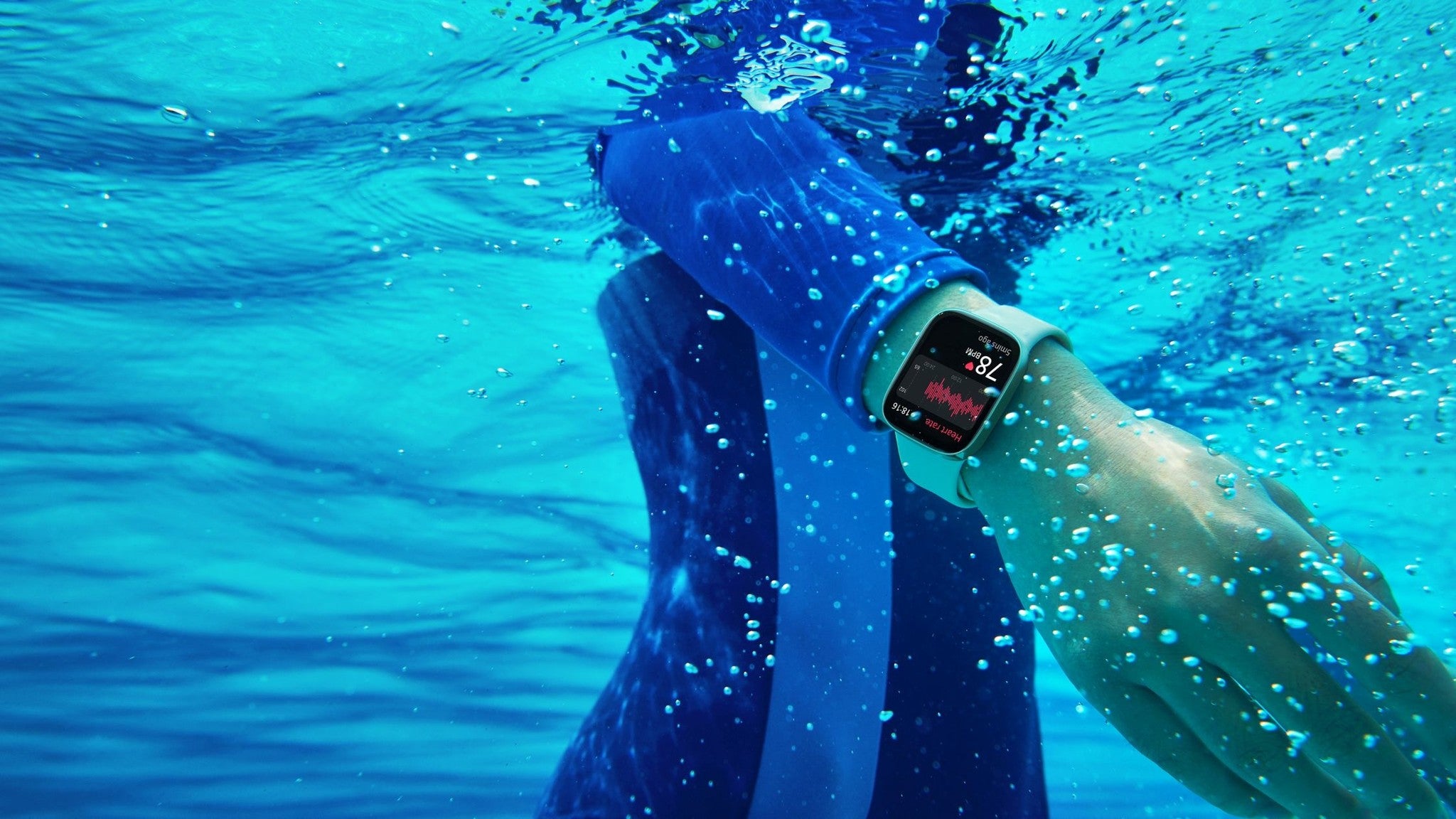 Xiaomi Redmi Watch 3